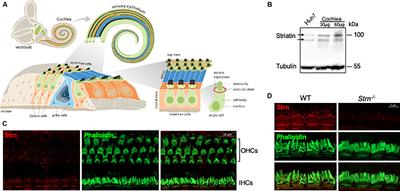 Striatin Is Required for Hearing and Affects Inner Hair Cells and Ribbon Synapses